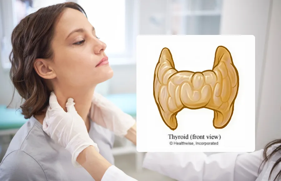 Adult Hyperthyroidism Care Instructions