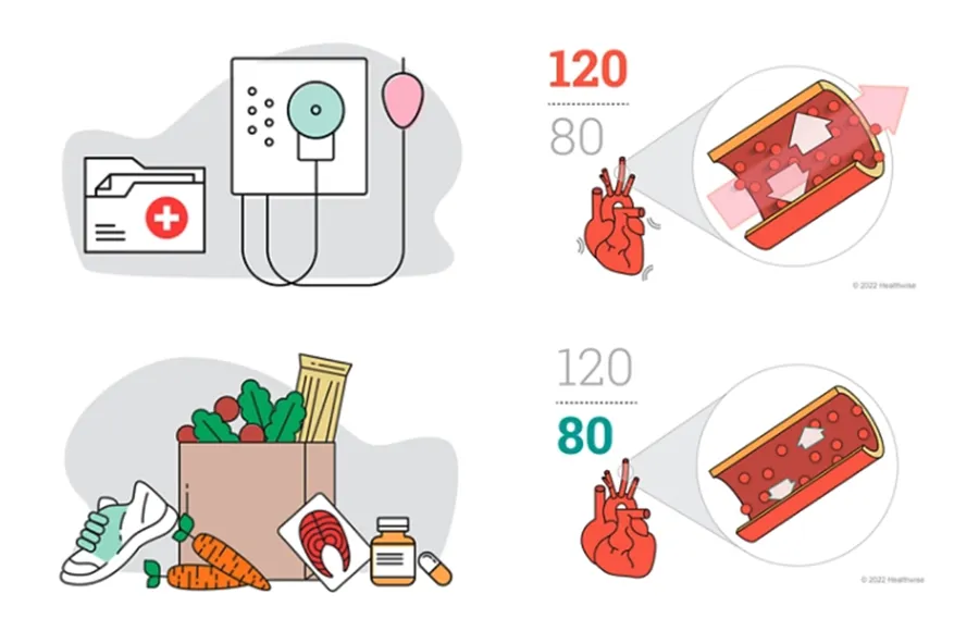 Learning About High Blood Pressure